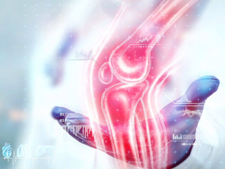 Osteoporosis Physiotherapy